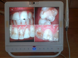 Интраоральная камера с монитором